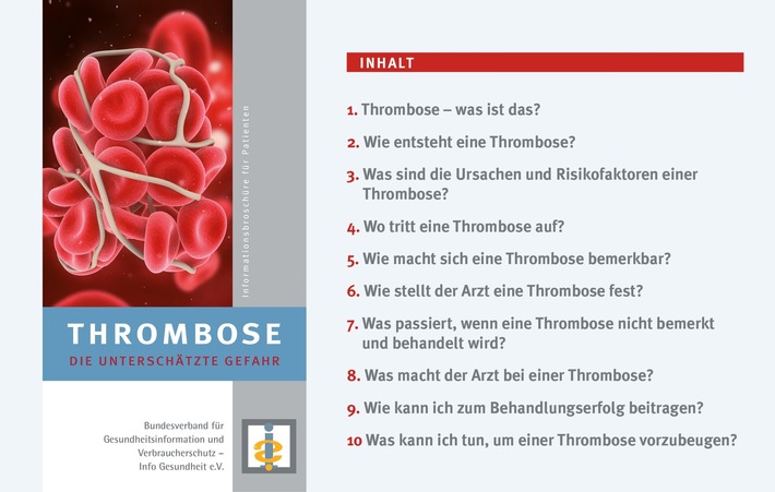 Risiko "Homeoffice-Thrombose"