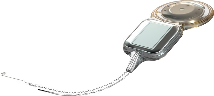 Erstes und einziges smartes Cochlea-Implantat beim HNO-Kongress in Ulm: Cochlear™ informiert über aktuelles Potenzial und zukünftige Möglichkeiten von Cochlear™ Nucleus® Nexa™