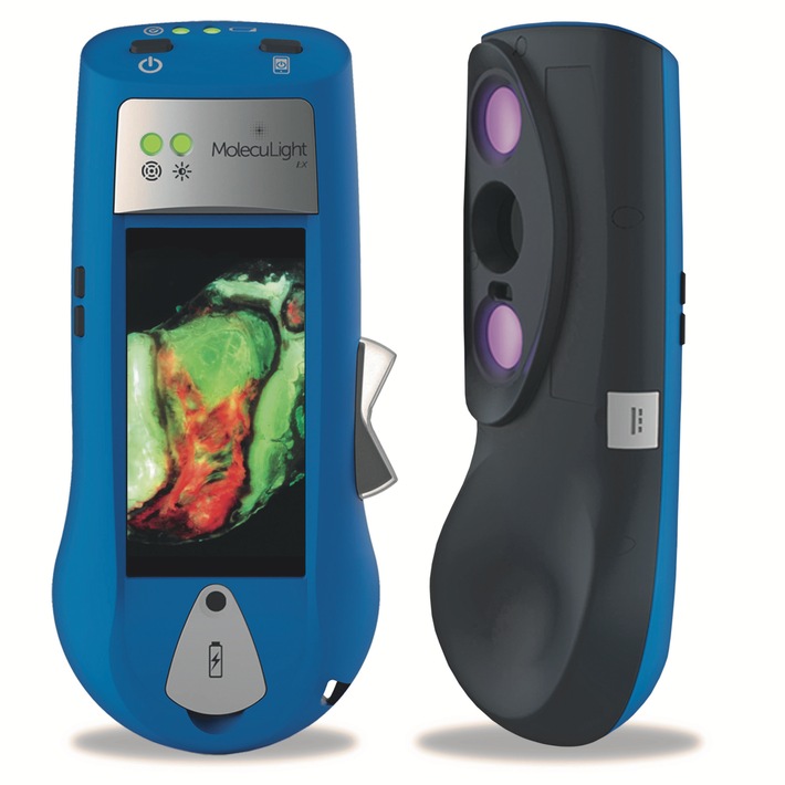 Smith &amp; Nephew annuncia il lancio europeo di una nuova tecnologia di imaging portatile a fluorescenza, aprendo una nuova epoca di processi decisionali per la cura delle ferite basati sull&#039;evidenza