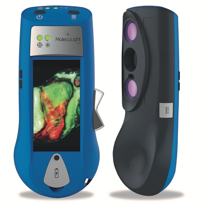 Smith & Nephew annuncia il lancio europeo di una nuova tecnologia di imaging portatile a fluorescenza, aprendo una nuova epoca di processi decisionali per la cura delle ferite basati sull