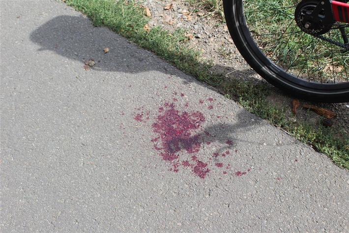 POL-PDKL: Radfahrer nach Sturz ins Krankenhaus gebracht