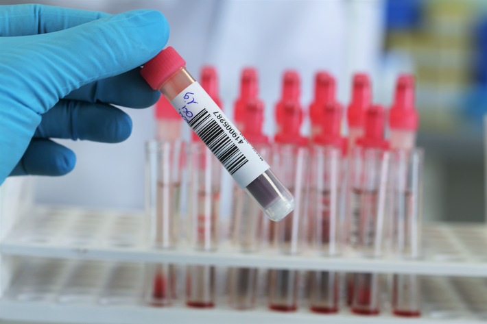 Zyagnum erhält IVDR-Zertifizierung für Multi-Cancer-Early-Detection-Test PanTum Detect®