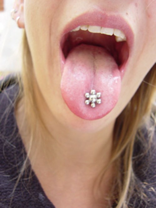 Societa Svizzera di Odontologia e Stomatologia: Il piercing - una moda esotica con effetti collaterali