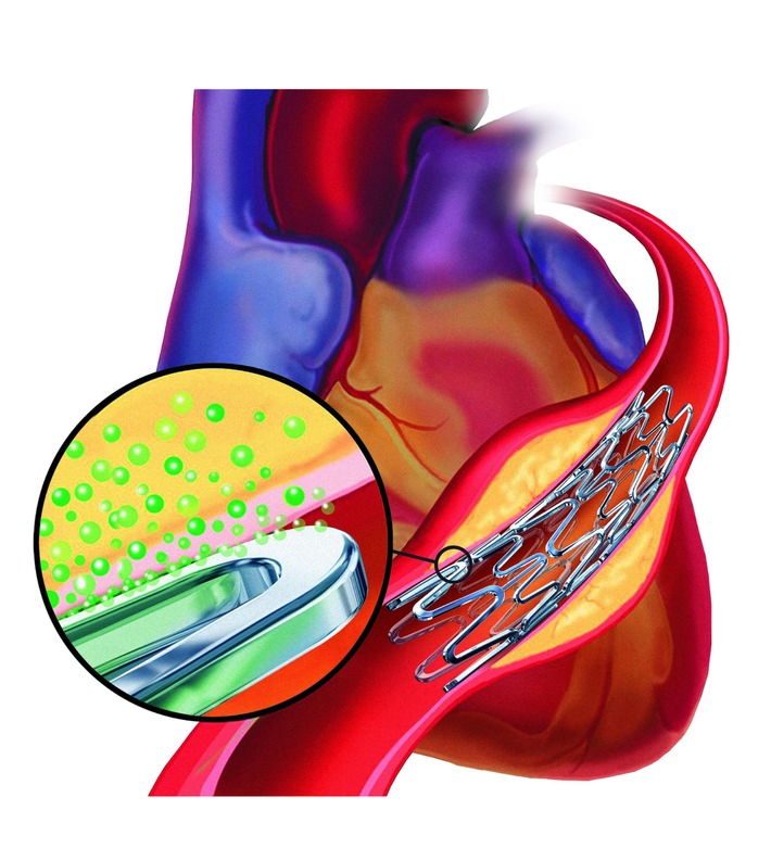 Studie TAXUS WOMAN zeigt positive klinische Behandlungsresultate für den TAXUS[TM] Arzneimittel-freisetzenden Stent bei Frauen