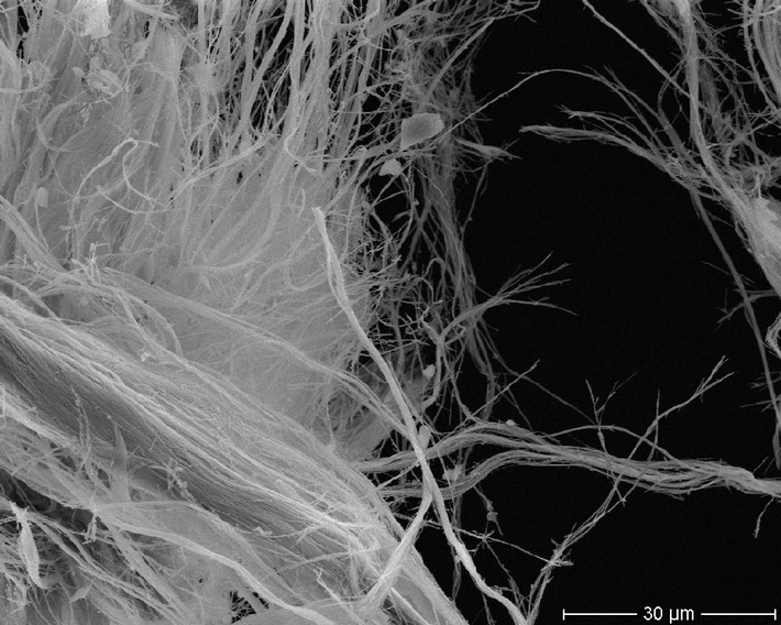 Nationales Asbest-Profil: Wundermineral hat sich in gefährliche Altlast verwandelt