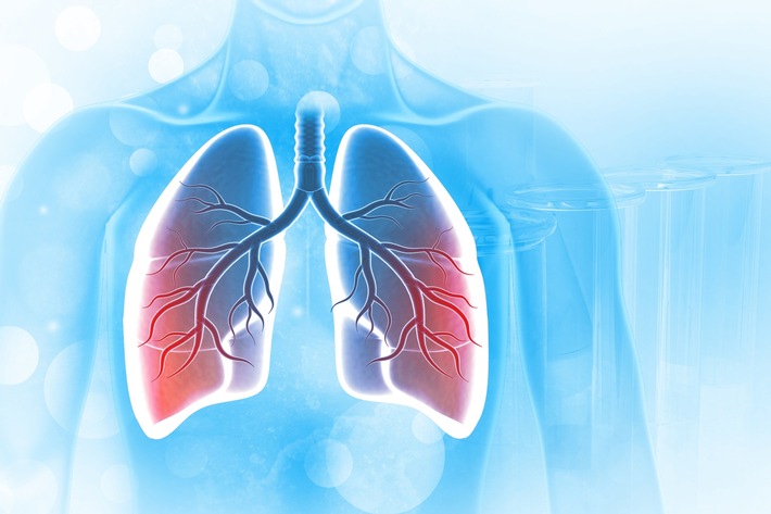Neue Ansätze in der Behandlung von Lungenkrebs