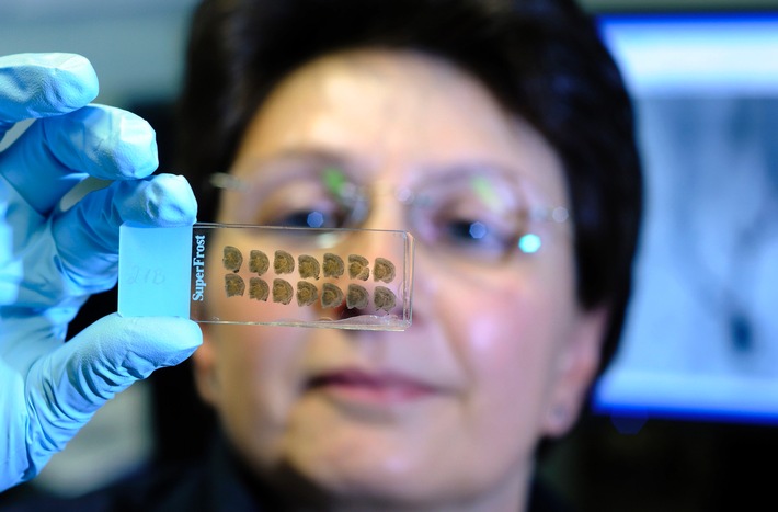 Biologikatherapie in Zeiten biologischer Nachahmerprodukte:
Noch kaum Erfahrungswerte zur Behandlung mit Biosimilars