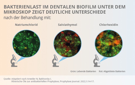 Pressemitteilung: Prophylaxe bei parodontalen Erkrankungen – Aktuelle ex-vivo/in-vitro-Studie mit Salviathymol® N Madaus zeigt vergleichbare antibakterielle Wirksamkeit auf die Biofilmaktivität wie Goldstandard Chlorhexidin (0,2 %)