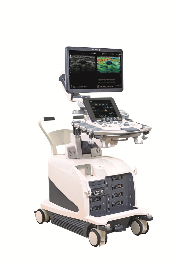 Hitachi Medical Systems Europe launches &quot;ARIETTA 750&quot;, the new model from the ARIETTA series of diagnostic ultrasound platforms / This model inherited premium class technologies