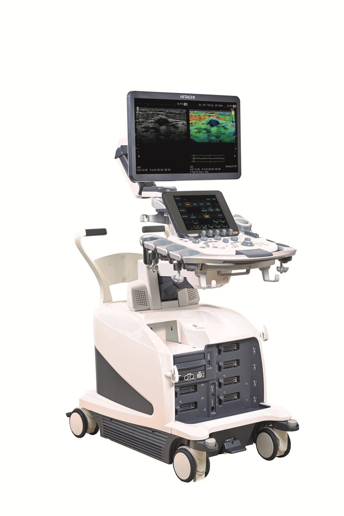 Hitachi Medical Systems Europe launches "ARIETTA 750", the new model from the ARIETTA series of diagnostic ultrasound platforms / This model inherited premium class technologies