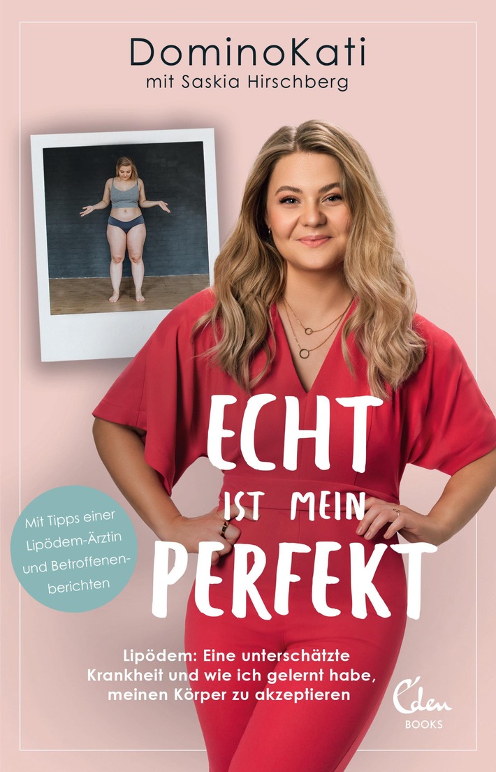 Lipödem: Jede zehnte Frau in Deutschland ist betroffen! / YouTuberin DominoKati macht mit ihrem Buch &quot;Echt ist mein Perfekt&quot; Betroffenen Mut und setzt sich gegen Bodyshaming ein