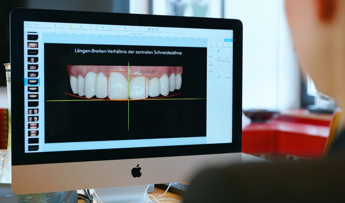 Perfektes Lächeln ohne Überraschungen: Zahnsanierung mit Digital Smile Design (DSD) bei KU64