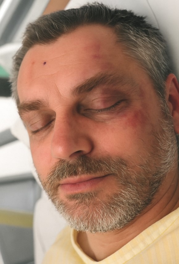 POL-GÖ: (177/2025) Von Unbekannten massiv verletzt - Amtsgericht ordnet Veröffentlichung von Foto eines vor zwei Jahren in Göttingen schwer verletzten Mannes an, Hintergründe und Tatmotiv weiter ungeklärt