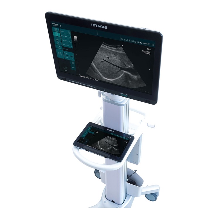 Hitachi Aloka launches two new, highly flexible Diagnostic Ultrasound Systems, ARIETTA Precision and ARIETTA Prologue