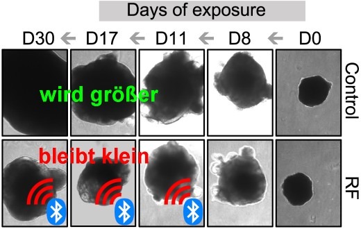 Bluetooth-Strahlung verzögert Gehirnentwicklung vor der Geburt