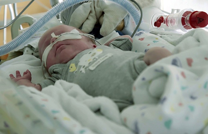 Specific identification of chronic lung disease in premature babies