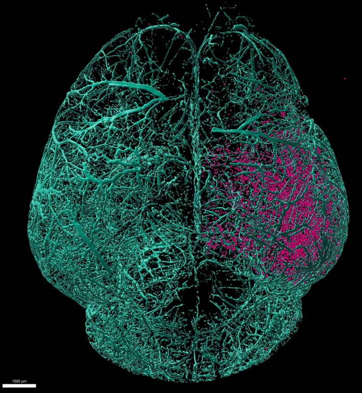 Sauerstoffmangel während der Geburt: Von schädlichen zu heilenden Immunzellen
