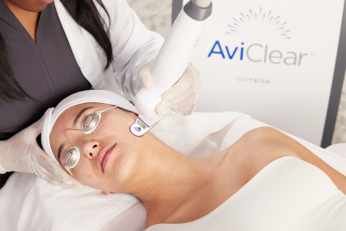 AviClear: Akne jetzt direkt an der Wurzel behandeln