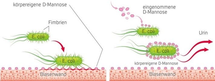 D-Mannose ummantelt die E. coli Bakterien und verhindert so, dass sie sich an der Blasenwand festsetzen / Weiterer Text über ots und www.presseportal.de/nr/132812 / Die Verwendung dieses Bildes ist für redaktionelle Zwecke unter Beachtung ggf. genannter Nutzungsbedingungen honorarfrei. Veröffentlichung bitte mit Bildrechte-Hinweis.