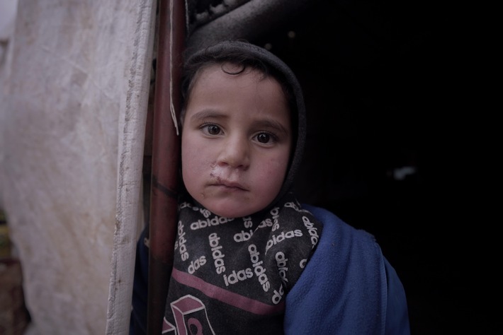 In Syrien schaut das jüngste Kind von Um Ibrahim in die Kamera. Für Familien wie ihre bedeutet der Winter einen alljährlichen Überlebenskampf. / Weiterer Text über ots und www.presseportal.de/nr/50131 / Die Verwendung dieses Bildes für redaktionelle Zwecke ist unter Beachtung aller mitgeteilten Nutzungsbedingungen zulässig und dann auch honorarfrei. Veröffentlichung ausschließlich mit Bildrechte-Hinweis.