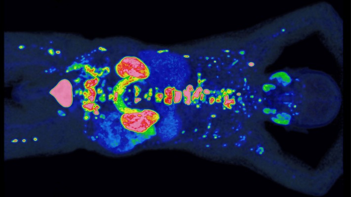 PROMISE erhält Preis der Deutschen Hochschulmedizin: Neue Methode verbessert Prognose und Therapie von Prostatakrebs