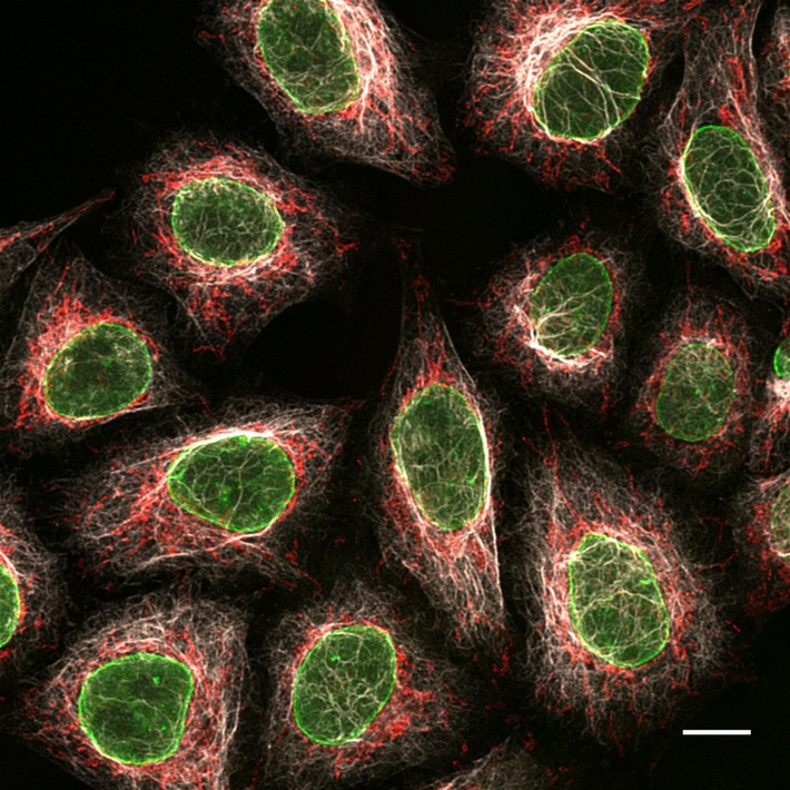 ChromoTek entwickelt nächste Generation sekundärer Antikörper