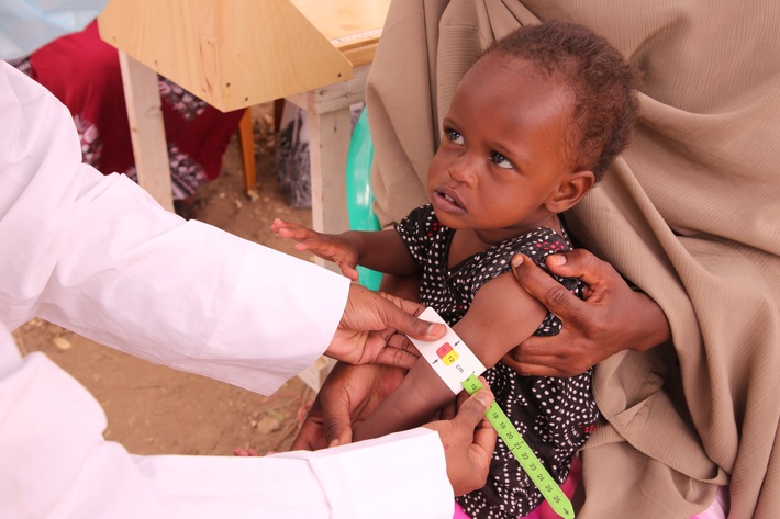 Screening von Unterernährung in Somalia.JPG