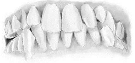 Zahnschema