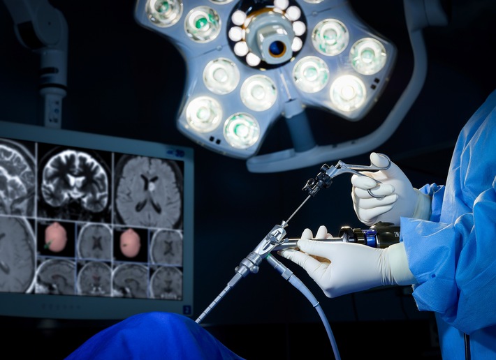 KARL STORZ startet in Europa wieder in der Neurochirurgie durch