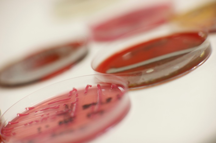 Hamburger Asklepios Kliniken schützen ihre Patienten besonders gut vor gefährlichen Bakterien