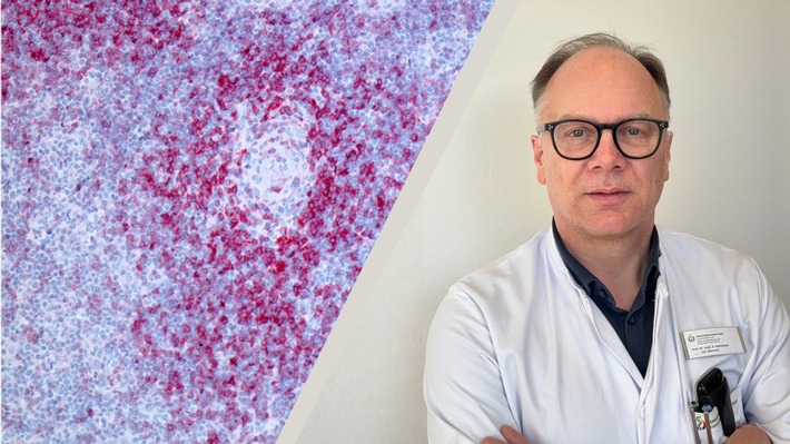 Bessere Therapie gegen schwer behandelbaren Lymphdrüsenkrebs: DFG fördert Forschungsprojekt REACT