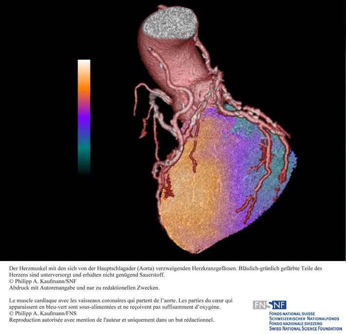 FNS: Image de la recherche mai 2010: Mise en oeuvre d&#039;une technique d&#039;imagerie combinée pour une amélioration du diagnostic