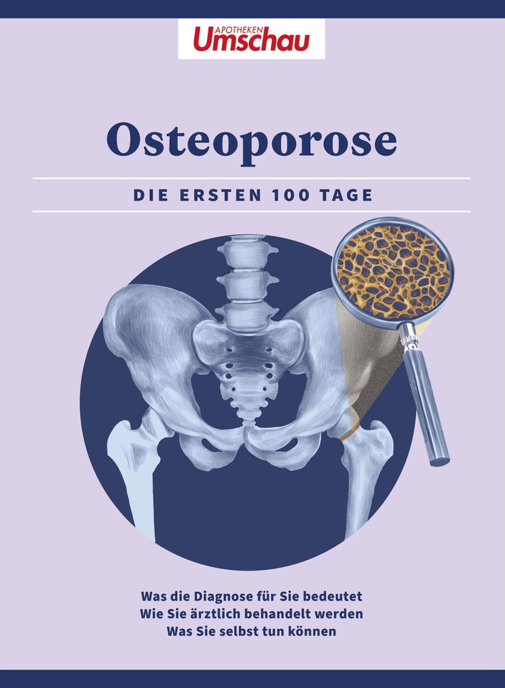 Neuer Apotheken Umschau-Ratgeber: "Osteoporose - Die ersten 100 Tage"