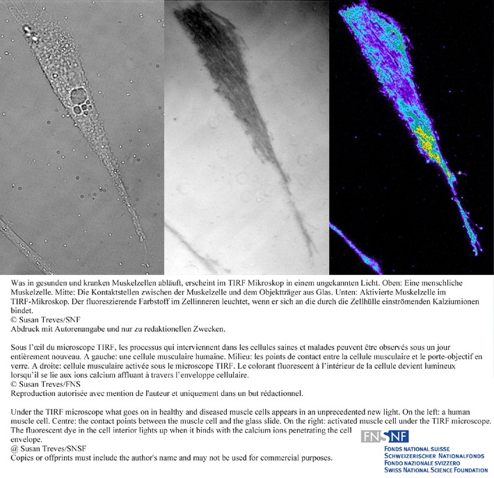 SNF: Bild der Forschung: Neuartiges Mikroskop erlaubt ungekannte Einblicke in Muskelzellen