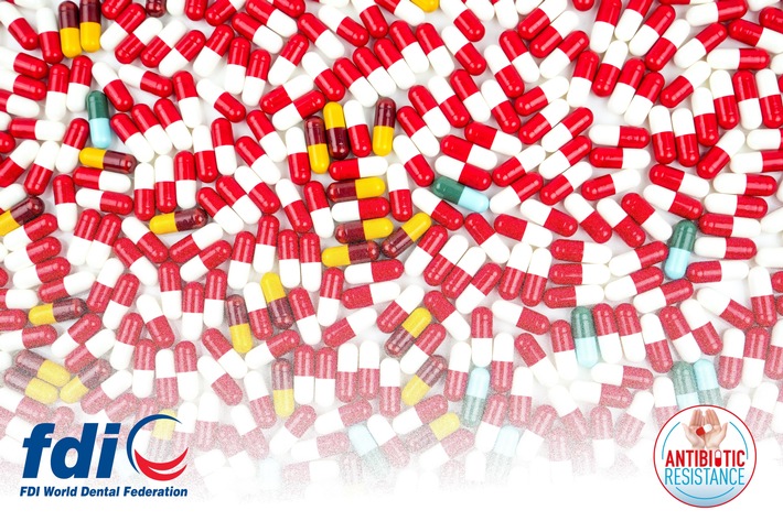 Studie zeigt drastisch erhöhten Einsatz von Antibiotika im Rahmen zahnärztlicher Behandlungen während des zurückliegenden COVID-19-Lockdowns in England
