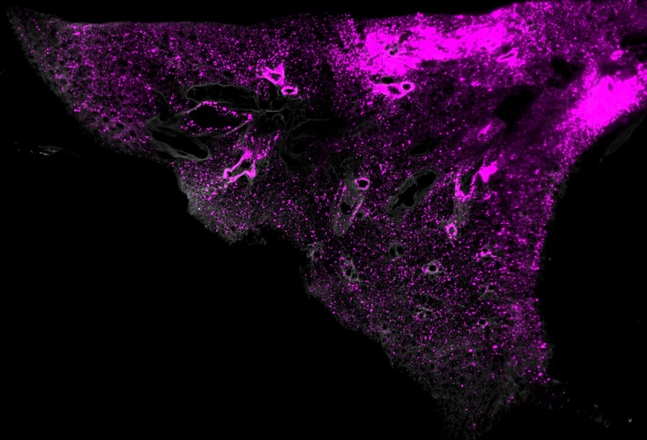 SCP-Nano: Eine neue Technologie zur Visualisierung von Nanocarriern in Zellen und Geweben