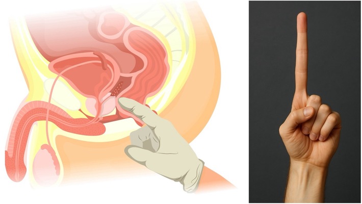 Prostatakrebsvorsorge: Abtasten bringt nichts! / PSA-Test und MRT setzen sich durch