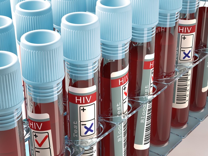 Mit HIV alt werden - Fortschritte in der AIDS-Therapie