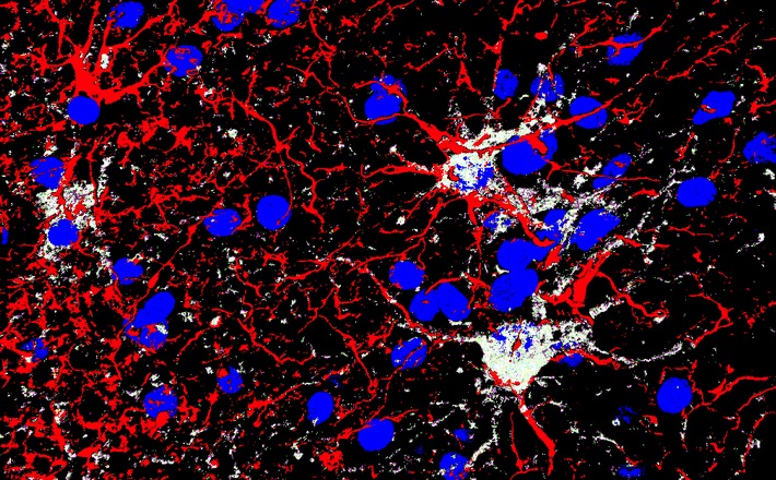 Neuer Ursprung von Stammzellen bei Patienten mit Hirnschäden entdeckt