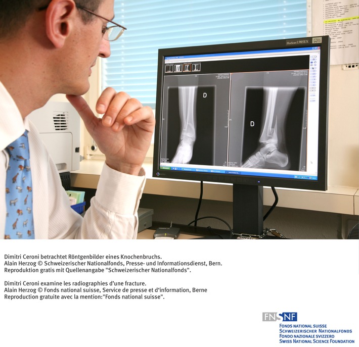 FNS: Image du mois octobre 2006: Observation à long terme des  fractures osseuses chez les enfants et les adolescents