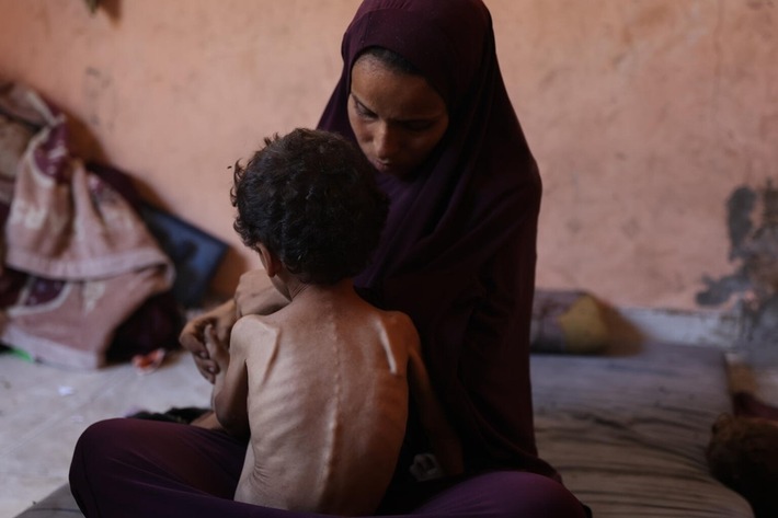 Gaza: Schwellenwerte für Hungersnot teilweise überschritten | WFP & UNICEF