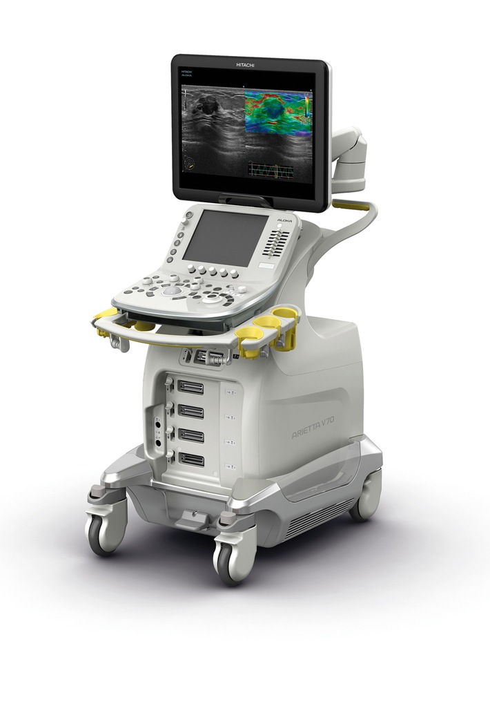 Hitachi Aloka will present the ARIETTA V70*1 with enhanced Elastography functions