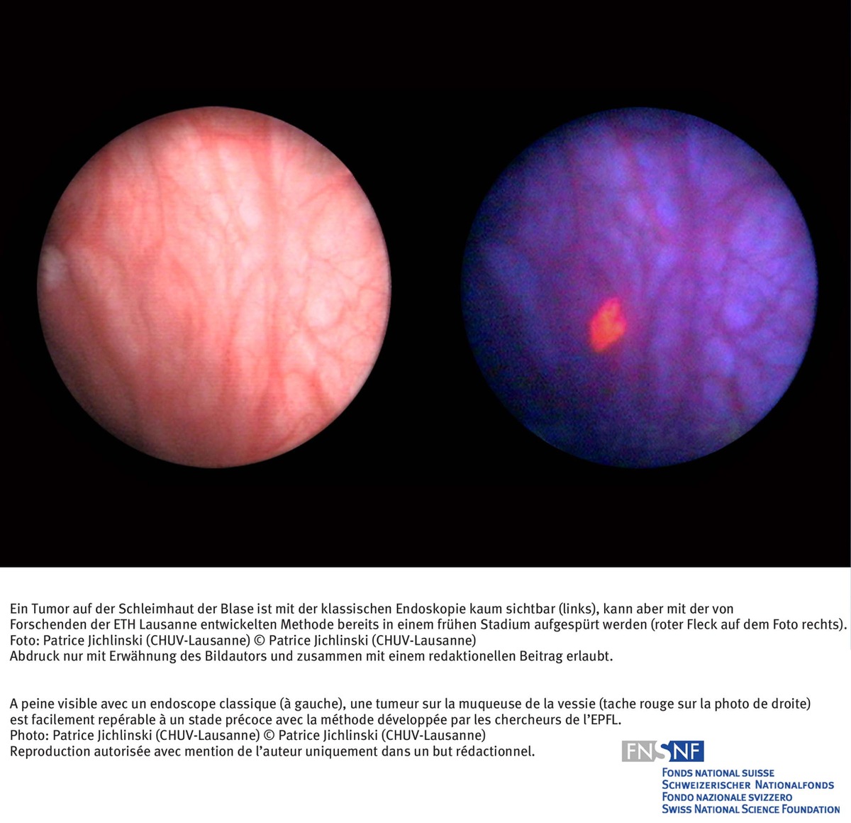 FNS: Image du mois août 2006: Un beau succès de la recherche  fondamentale