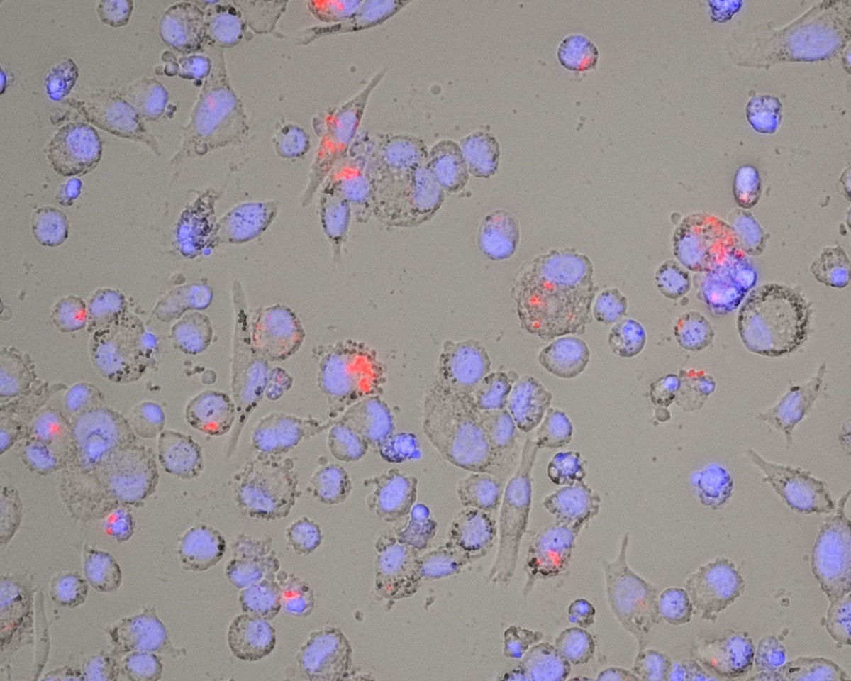 Mukoviszidose e.V. finanziert Forschungsprojekt zur Mycobacterium abscessus-Therapie