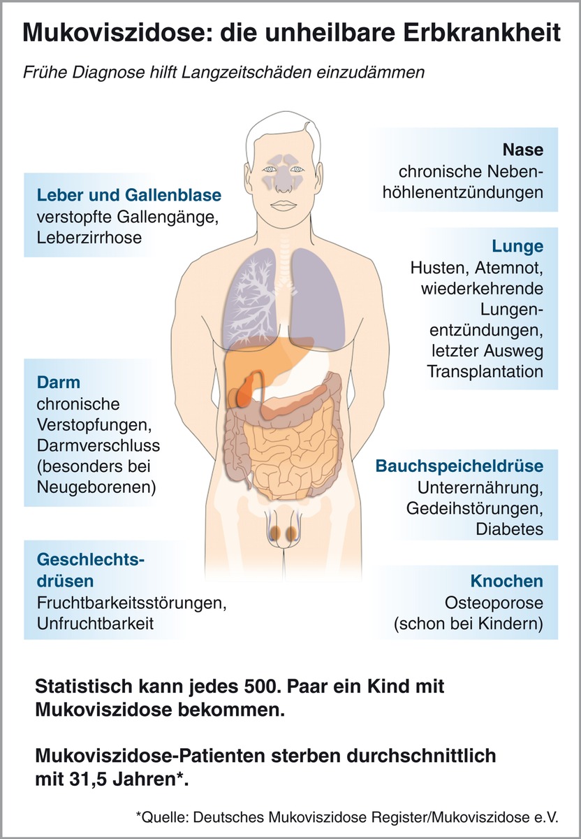 Mukoviszidose e.V. begrüßt Entscheidung des G-BA / Screening auf Mukoviszidose bald für alle Neugeborenen in Deutschland