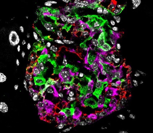 Betazellfunktion im Tiermodell wiederhergestellt: Neue Wirkstoffkombination könnte Diabetes-Remission ermöglichen