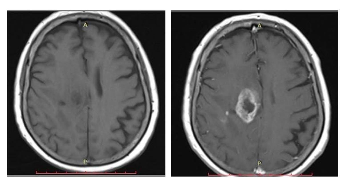 Meilenstein für die radiologische Diagnostik