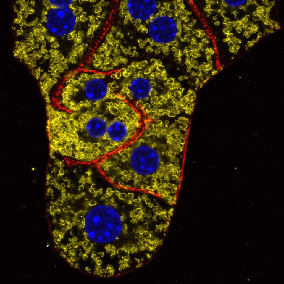 Discovery of potential novel therapeutic target for non-alcoholic fatty liver disease