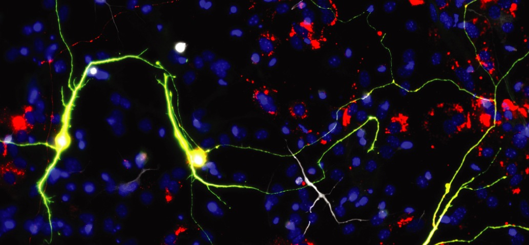 Forschende verbessern neuronale Reprogrammierung durch Manipulation der Mitochondrien