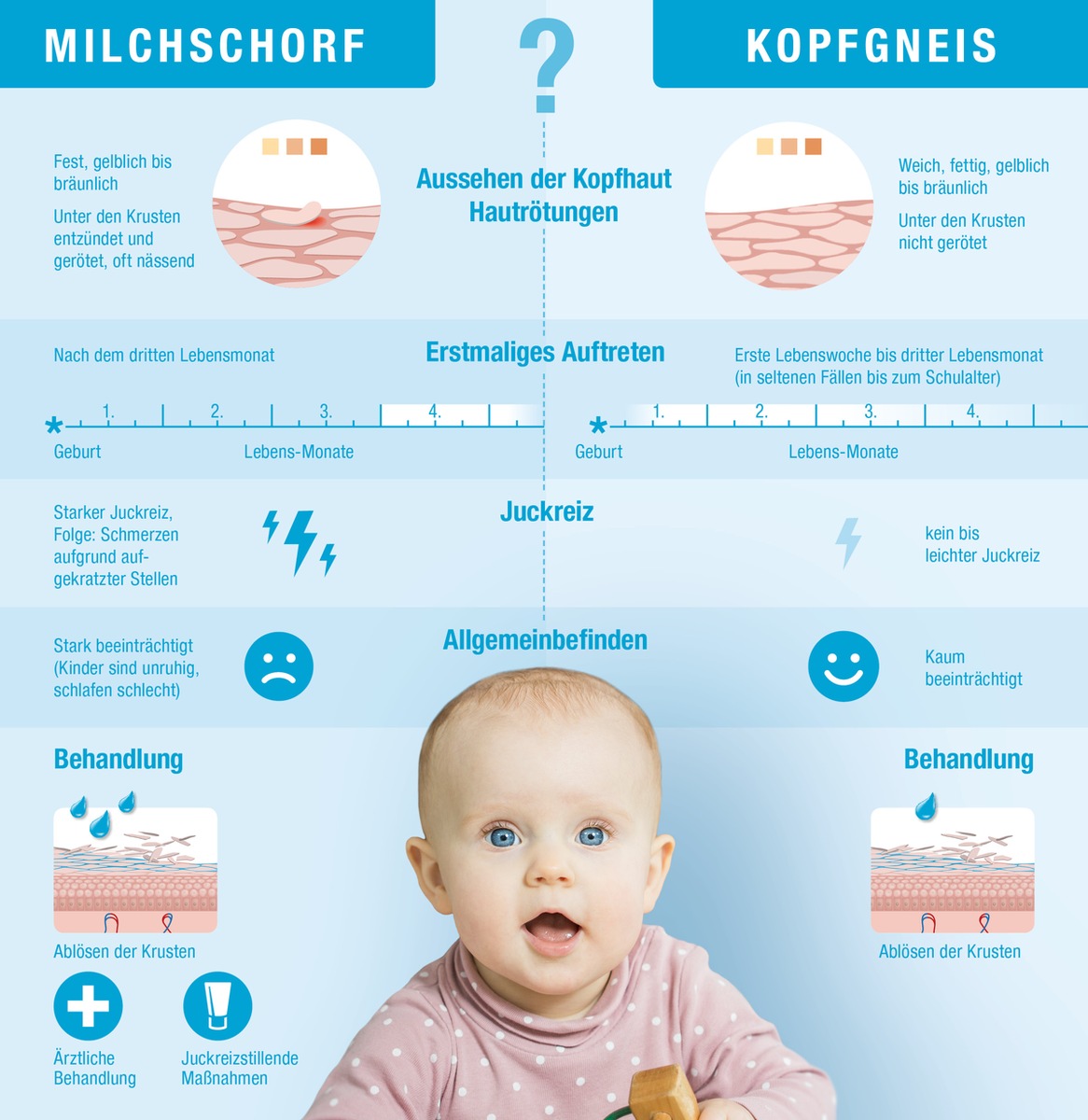 Tag des Babys am 2. Mai 2017 / Milchschorf oder Kopfgneis - Kennen Sie den Unterschied?